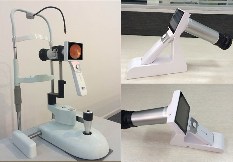 HFC-1 Portable Fundus Camera