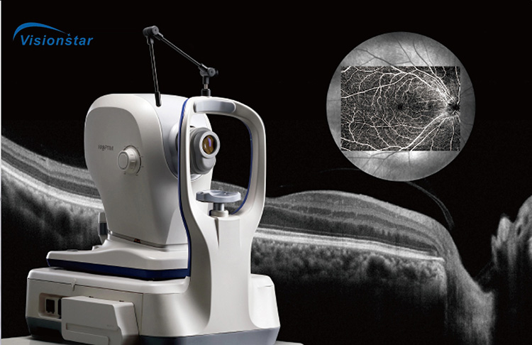 OSE-4000 Optical Coherence Tomography