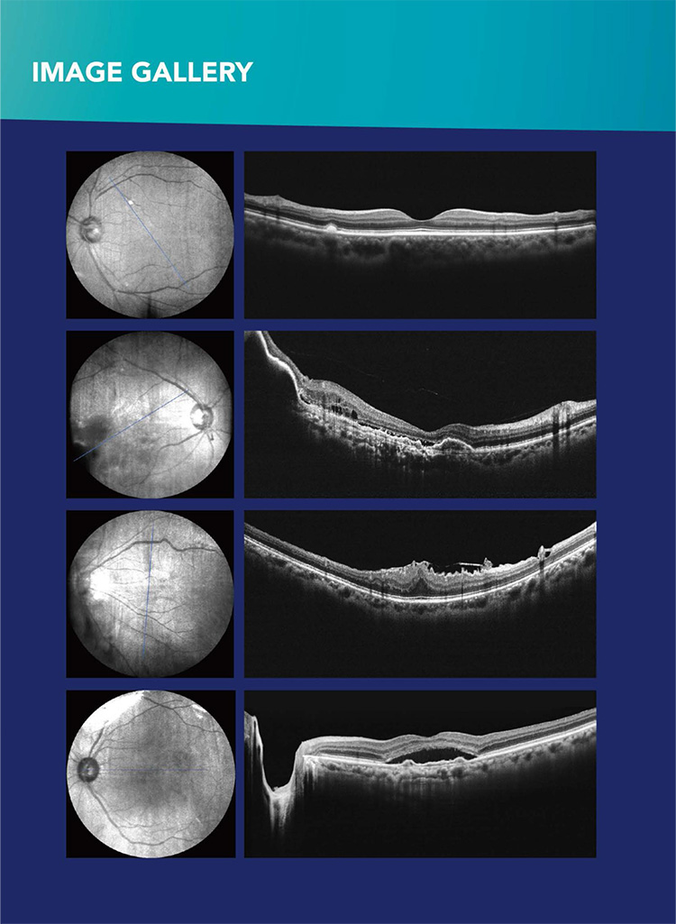 OSE-3000 OCT Optical Coherence Tomography