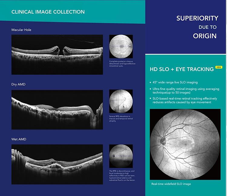 OSE-4000 Optical Coherence Tomography