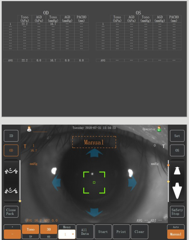 NCT-100 Full Auto Non-contact Tonometer