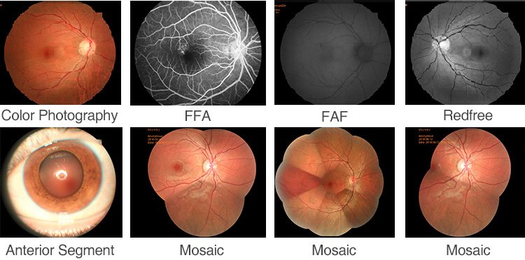 APS-CER Fundus Camera with Auto FAF