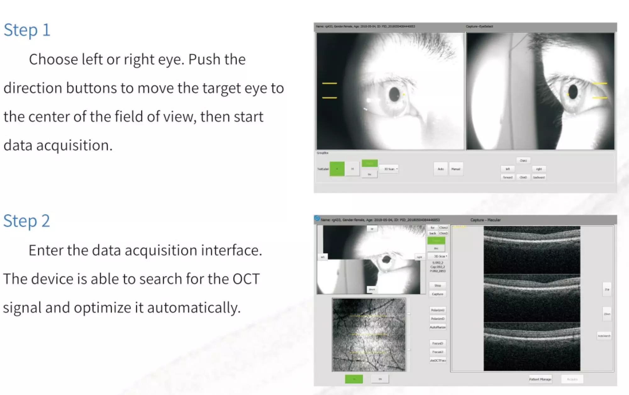 OCT-500 Optical Coherence Tomography