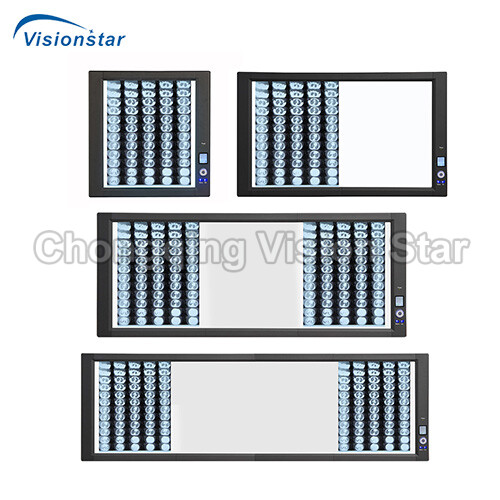 XFV X-Ray Film Viewer