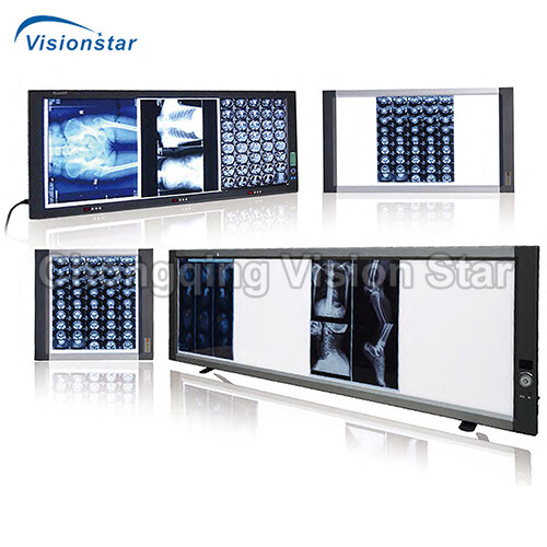 XFV9C LED X-Ray Film Viewer