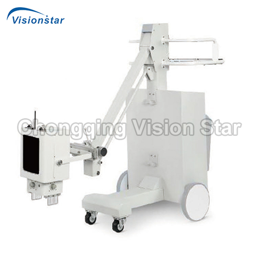 XMX56C Mobile X-ray Machine