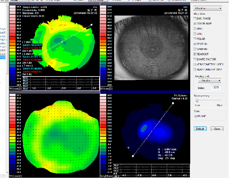 SW-6000 Corneal Topography Machine