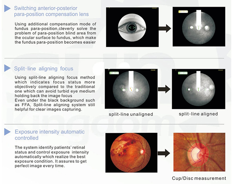 SK-650A Fundus Camera