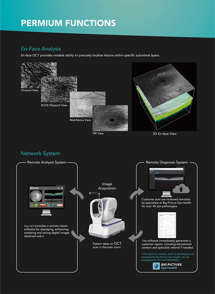 OSE-3000 OCT Optical Coherence Tomography