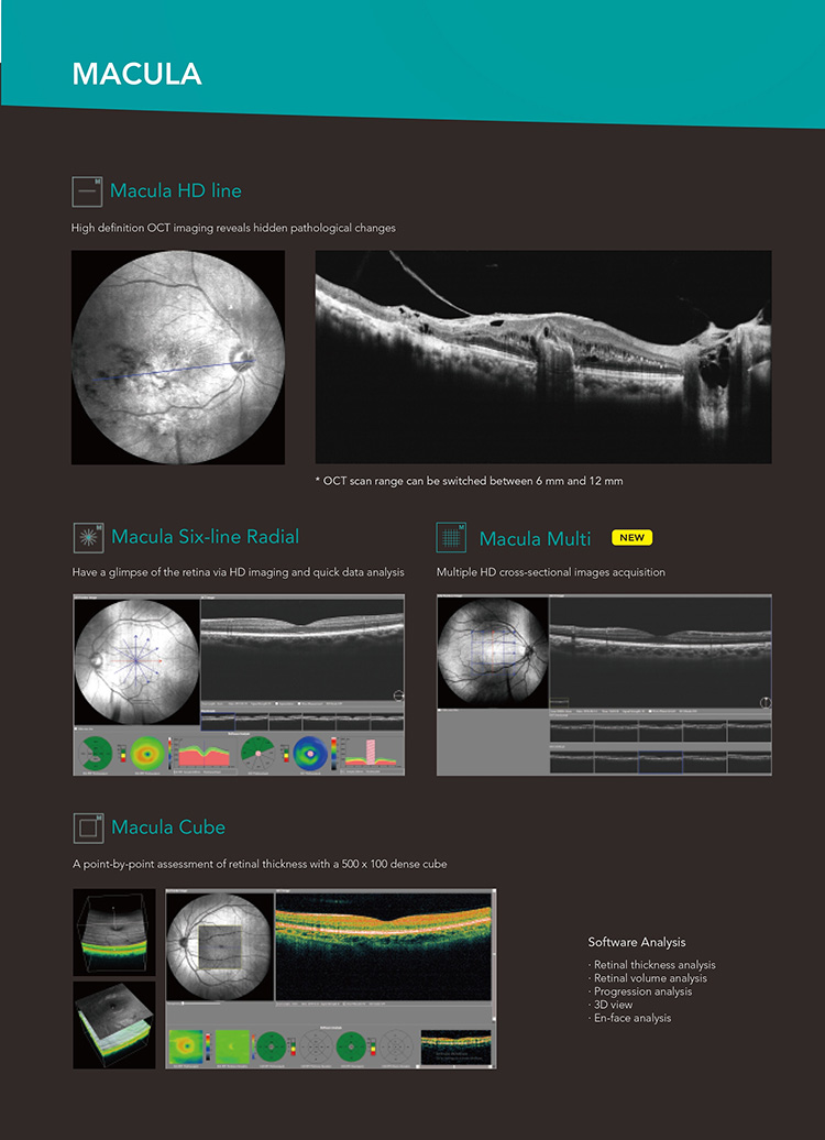 OSE-4000 Optical Coherence Tomography