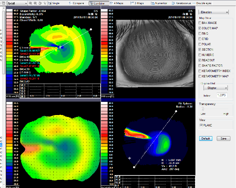 SW-6000 Corneal Topography Machine