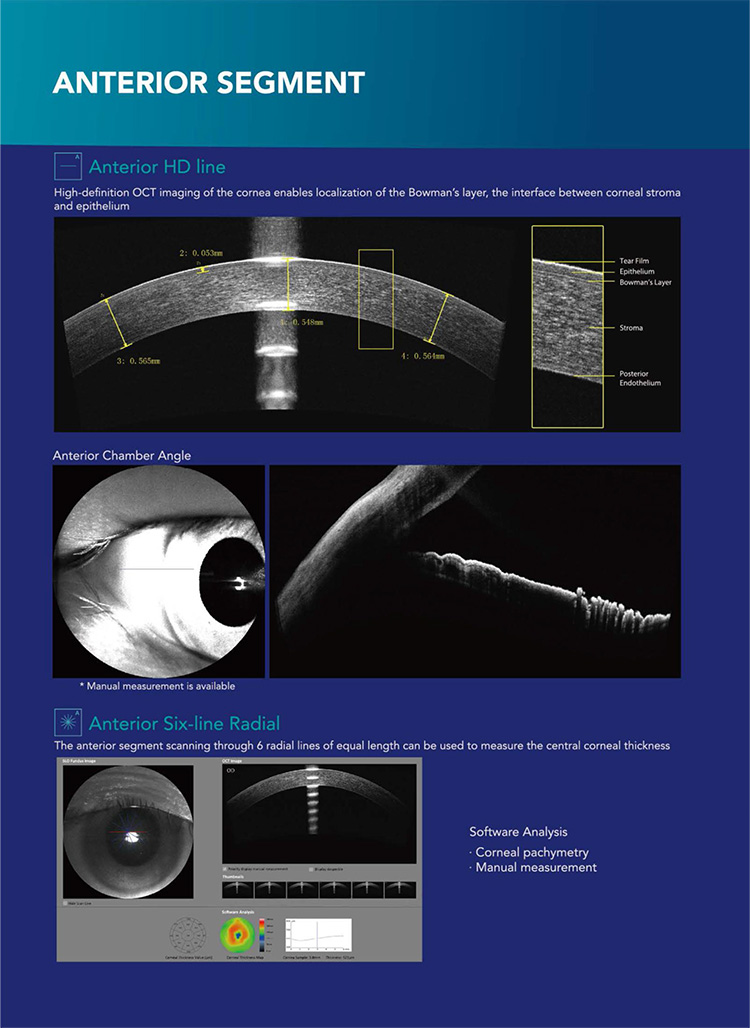 OSE-3000 OCT Optical Coherence Tomography