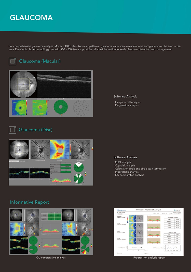 OSE-4000 Optical Coherence Tomography