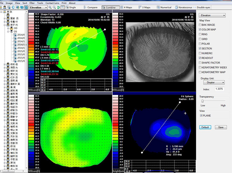 SW-6000 Corneal Topography Machine