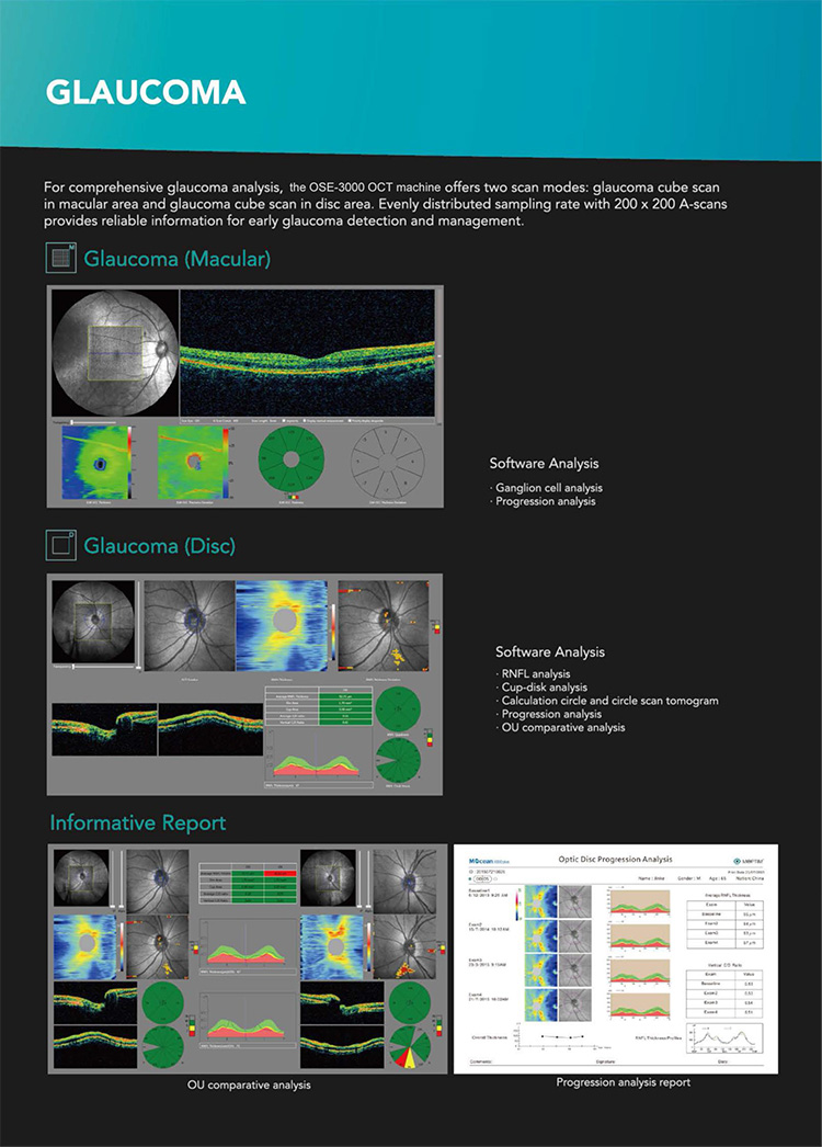 OSE-3000 OCT Optical Coherence Tomography