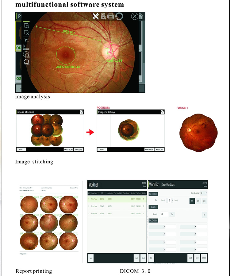 APS-CER Fundus Camera with Auto FAF