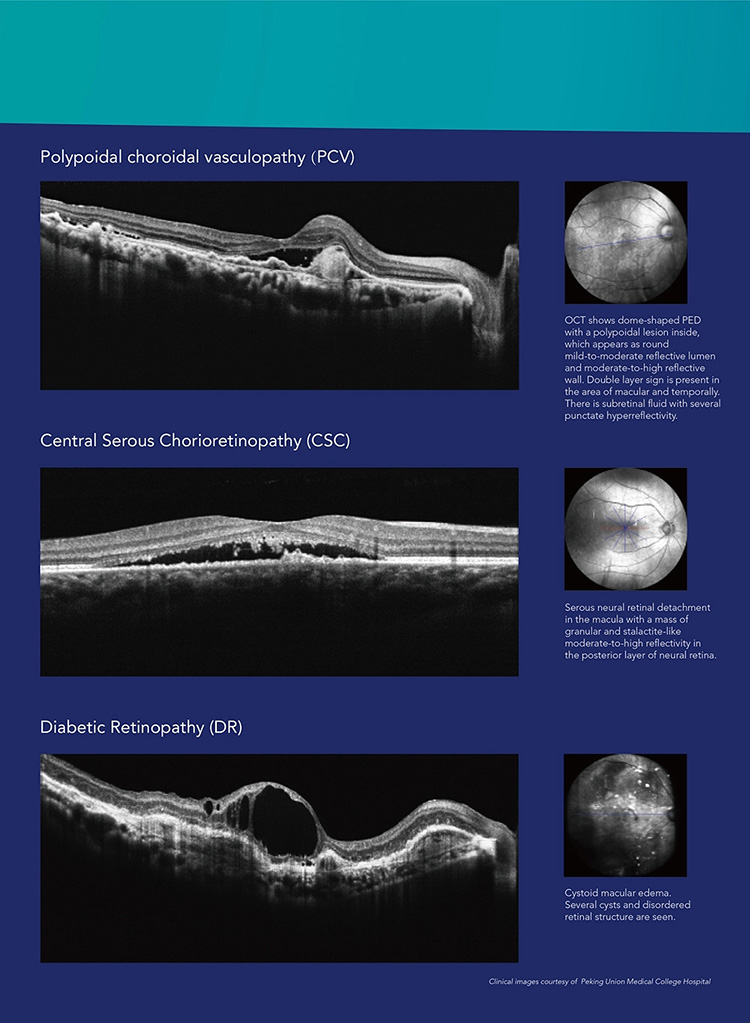 OSE-4000 Optical Coherence Tomography