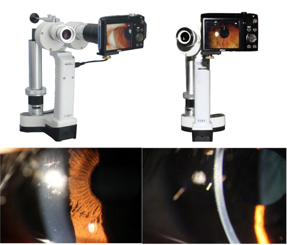 KJ5S3 Portable Slit Lamp Microscope