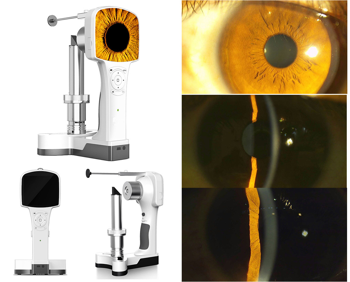 VSO-600 Portable Slit Lamp