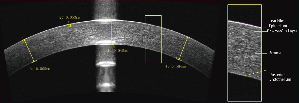 OSE-2800 OCT Optical Coherence Tomography