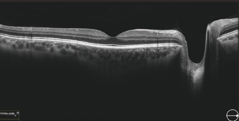 OSE-2800 OCT Optical Coherence Tomography