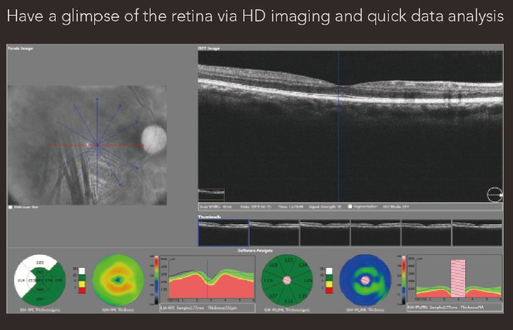 OSE-2800 OCT Optical Coherence Tomography