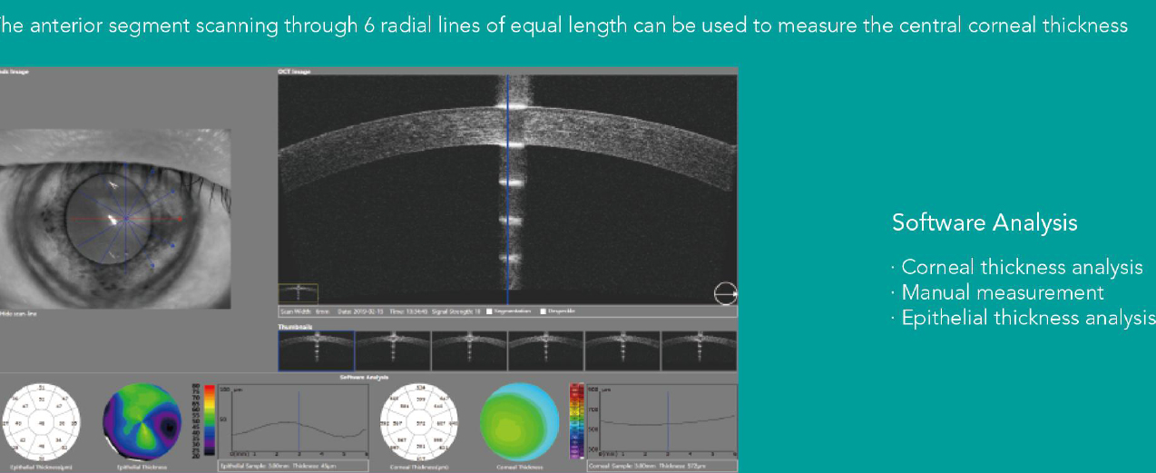 OSE-2800 OCT Optical Coherence Tomography